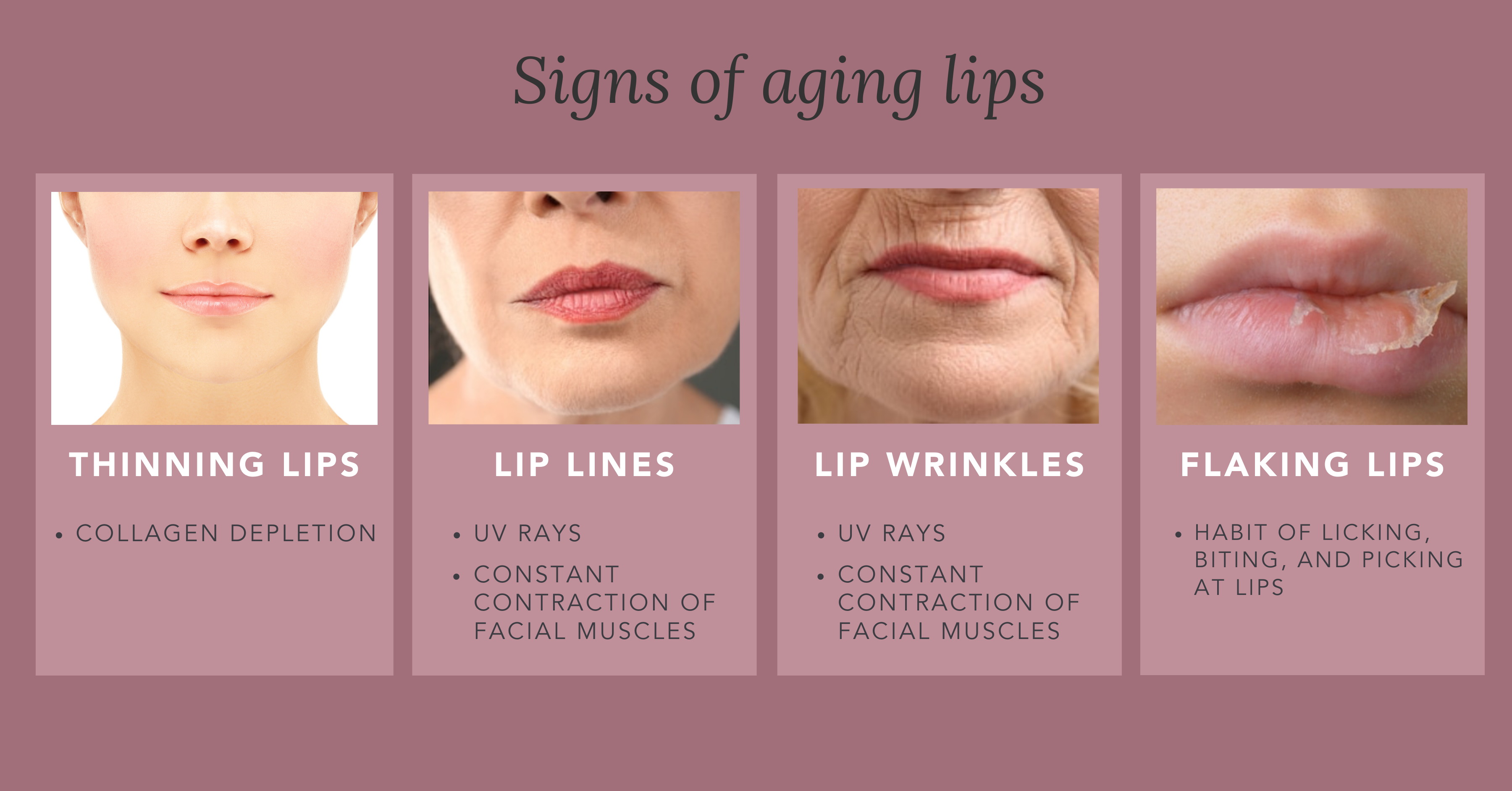 How do Your Lips Age, and What are the Signs of Pre-mature Aging? 4