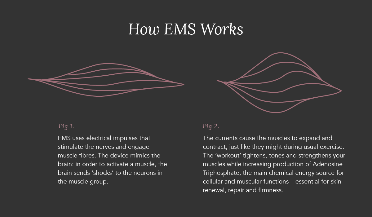 https://blog.theahomebeauty.com/hs-fs/hubfs/Blog%20Imges/Technology%20Explained/EMS/EMS_A.png?width=1200&name=EMS_A.png