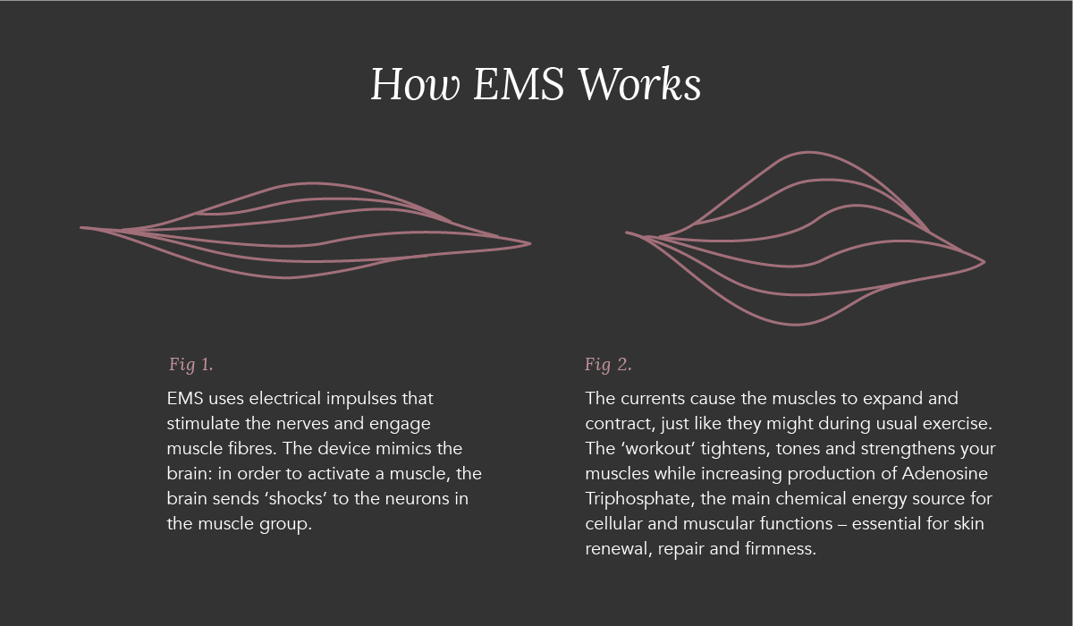 Electrical muscle stimulation: What it is, uses, and more