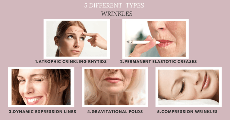 Different types of wrinkles