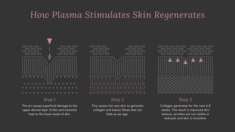 How Plasma Stimulates Skin Regenerates